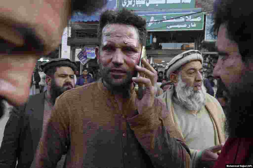 An injured victim talks on his mobile phone after getting treatment outside a hospital in Peshawar. The incident comes nearly a year after a suicide bombing killed 63 people in a Shi'a mosque in Peshawar. 
