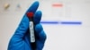 WADA оприлюднило свідчення державної підтримки допінгу у Росії
