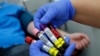 Blood samples donated by recovered novel coronavirus patients for plasma extraction (file photo)