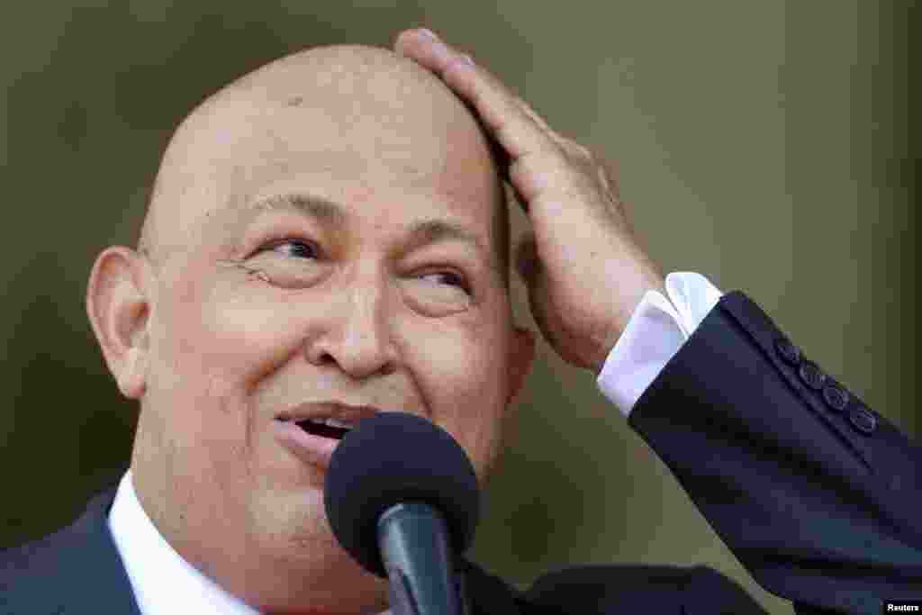 Hugo Chavez se šalio zbog izgubljene kose nakon liječenja karcinoma u bolnici u Caracasu, 24. august 2011. Foto: REUTERS / Jorge Silva